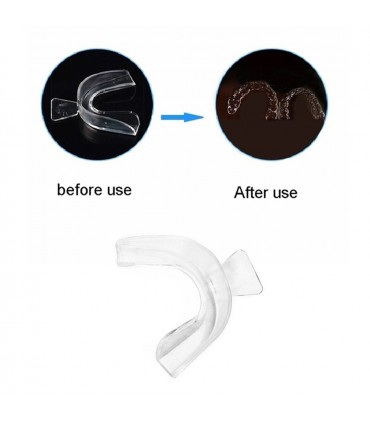 LONSDALE ΜΟΝΗ ΜΑΣΕΛΑ DENTURE clear